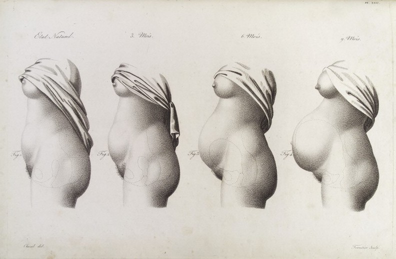 Stages in pregnancy as represented by the growth of the womb 19th Century Nouvelles démonstrations d'accouchemens. Avec des planches en taille-donee, accompagnées d'un texte raisonné, propre à en faciliter l'explication Jacques-Pierre Maygrier Published: 1822 Courtesy of Wellcome Library, London. Copyrighted work available under Creative Commons Attribution only licence CC BY 4.0